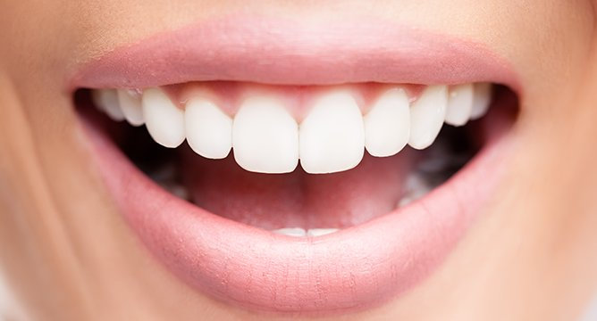 Beauty DIY: How To Whiten Your Teeth With Turmeric