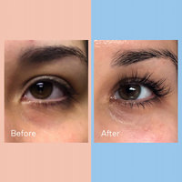 Say Hello to Longer Lashes With Latisse