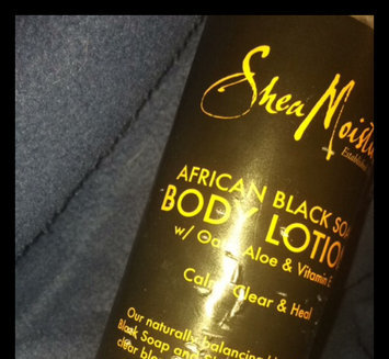 Photo of SheaMoisture African Black Soap Eczema Psoriasis Therapy Body Lotion uploaded by Abby D.