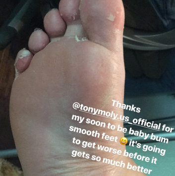 Photo of Tony Moly Foot Peeling Shoes uploaded by Lauren F.