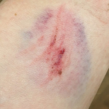Photo of Neosporin Plus Pain Relief uploaded by Jen S.