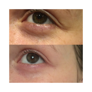 Photo of Nip + Fab Dragons Blood Fix Mask uploaded by Christie H.