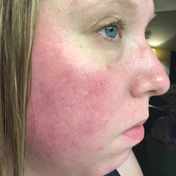 Photo of Lancôme Rénergie Lift Multi-Action Day Cream uploaded by Hannah S.