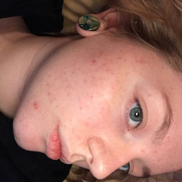 Photo of Mario Badescu Drying Mask uploaded by Avi G.