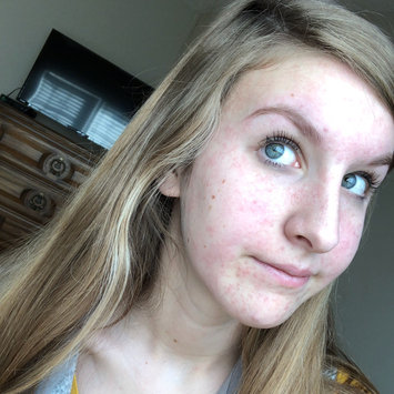 Photo of Bioré Charcoal Acne Clearing Cleanser uploaded by Kayla A.