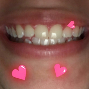 Photo of Crest 3D White Luxe Professional Effects Whitestrips Teeth Whitening Kit uploaded by Beatriz G.