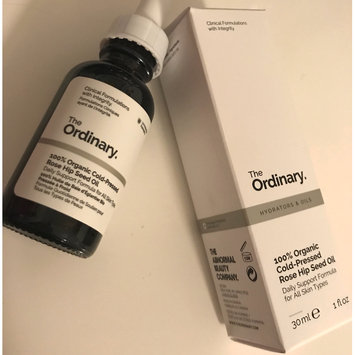 Photo of The Ordinary 100% Organic Cold-Pressed Rose Hip Seed Oil 1 oz/ 30 mL uploaded by Bethanie G.