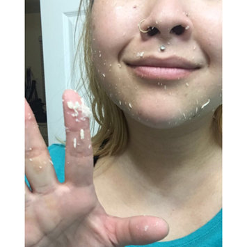 Photo of Peter Thomas Roth FIRMx Peeling Gel uploaded by Lily X.