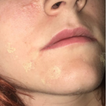 Photo of Mario Badescu Drying Cream uploaded by Megan N.