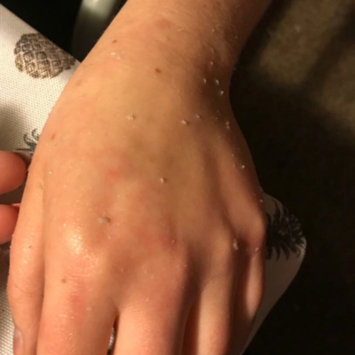 Photo of Peter Thomas Roth FIRMx Peeling Gel uploaded by Emilee C.