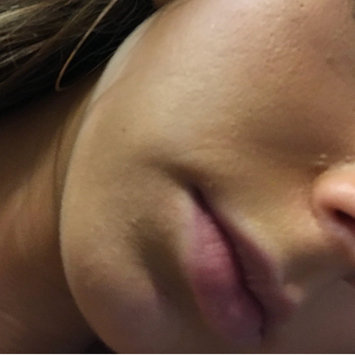Photo of Clinique Smart™ Custom-Repair Serum uploaded by JESS B.
