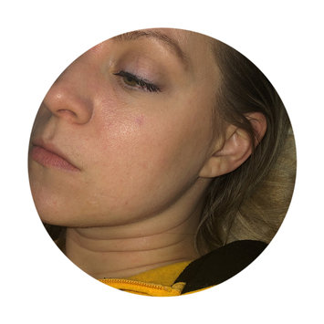 Photo of Murad Post-Acne Spot Lightening Gel uploaded by Natalie D.