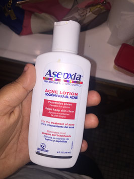Photo of Asepxia Astringent Lotion - 4 Oz uploaded by Yari D.