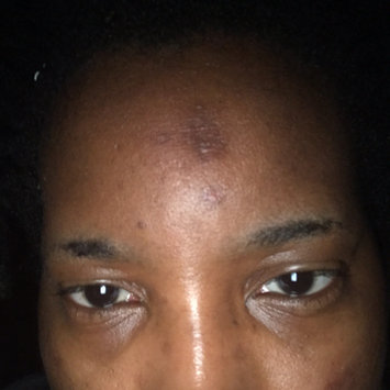 Photo of Nadinola Skin Discoloration Fade Cream uploaded by Alicia T.