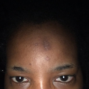 Photo of Nadinola Skin Discoloration Fade Cream uploaded by Alicia T.