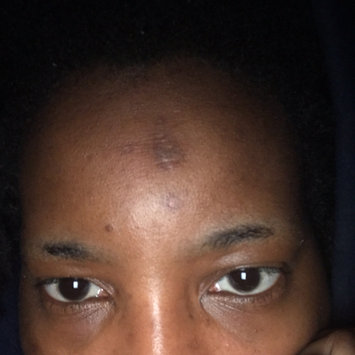 Photo of Nadinola Skin Discoloration Fade Cream uploaded by Alicia T.