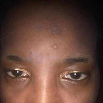 Photo of Nadinola Skin Discoloration Fade Cream uploaded by Alicia T.