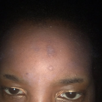 Photo of Nadinola Skin Discoloration Fade Cream uploaded by Alicia T.