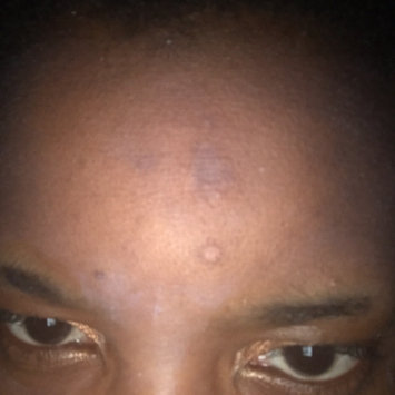 Photo of Nadinola Skin Discoloration Fade Cream uploaded by Alicia T.
