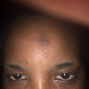 Photo of Nadinola Skin Discoloration Fade Cream uploaded by Alicia T.