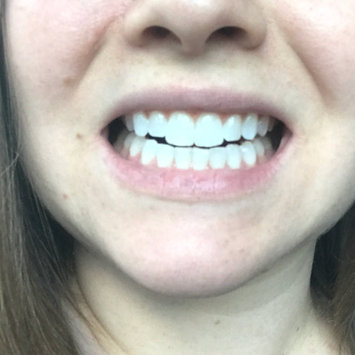 Photo of Crest 3D White Luxe Professional Effects Whitestrips Teeth Whitening Kit uploaded by Alissa H.