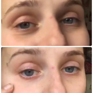 Photo of Biossance Squalane + Peptide Eye Gel uploaded by Katy M.