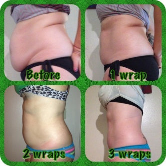 Photo of Ultimate Body Applicator uploaded by Elizabeth H.