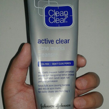 Photo of Clean & Clear® Advantage® Mark Treatment uploaded by imanda h.