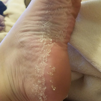 Photo of Tony Moly Foot Peeling Shoes uploaded by Angela P.