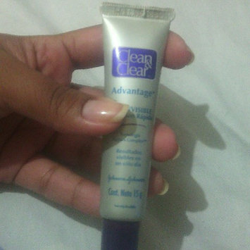 Photo of Clean & Clear® Advantage® Mark Treatment uploaded by migreg h.