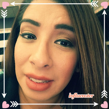 Photo of Murad Acne Clearing Solution uploaded by Yvette F.