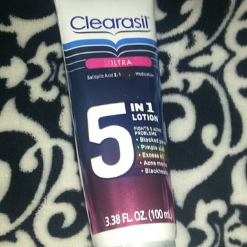Photo of CLEARASIL® Ultra 5 in 1 Lotion uploaded by Asher R.