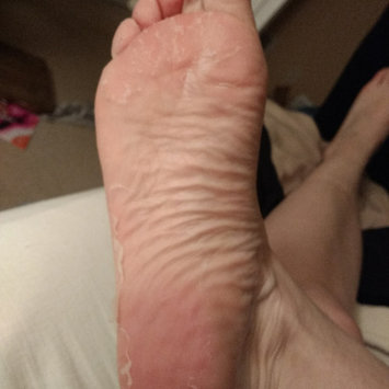Photo of Tony Moly Foot Peeling Shoes uploaded by Jada E.
