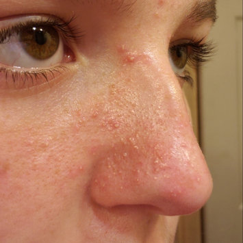 Photo of Bioré Deep Pore Charcoal Cleanser uploaded by Kelsey F.