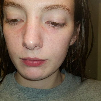 Photo of Dermalogica Clear Start Blackhead Clearing Fizz Mask uploaded by Autumn Ruby C.