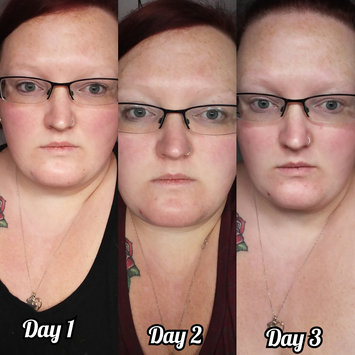 Photo of Clean & Clear Alcohol-Free Lemon Juice Facial Toner uploaded by Michelle H.