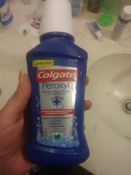 Photo of Colgate® Peroxyl® Mouth Sore Rinse Original Mint uploaded by Sarah G.