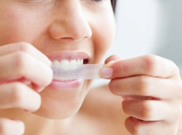 Photo of Crest 3D White Luxe Professional Effects Whitestrips Teeth Whitening Kit uploaded by F_A_T__i_M_A O.