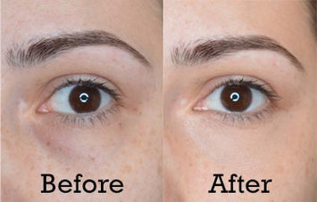 Photo of Benefit Cosmetics Boi-ing Airbrush Concealer uploaded by Theresa M.