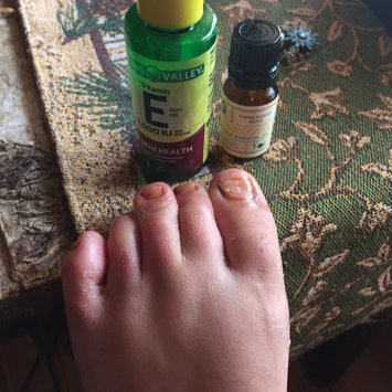 Photo of Spring Valley Vitamin E Skin Oil 12 uploaded by Amber G.