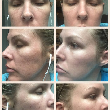 Photo of Obagi Nu-Derm Blend Fx Face Treatment Formula uploaded by Jennifer S.
