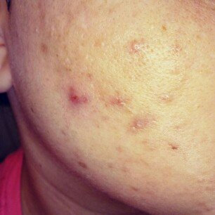 Photo of Paula's Choice Skin Balancing Super Antioxidant Concentrate Serum with Retinol uploaded by Tamara F.