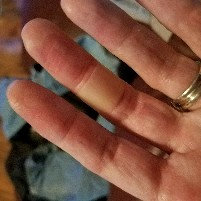 Photo of Band-Aid Advanced Healing Blister for Fingers & Toes uploaded by Sara B.