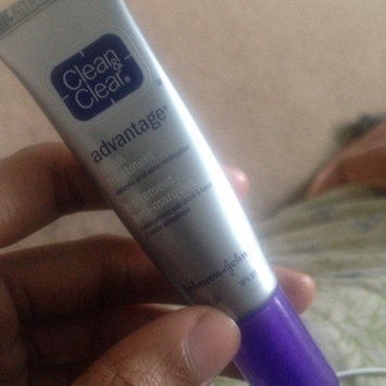 Photo of Clean & Clear® Advantage® Mark Treatment uploaded by Ashante T.