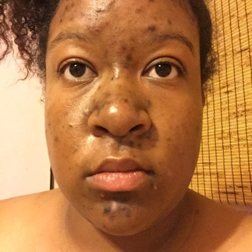 Photo of Nadinola Skin Discoloration Fade Cream uploaded by Kahloah D.
