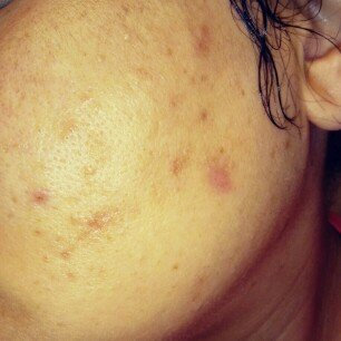 Photo of Paula's Choice Skin Balancing Super Antioxidant Concentrate Serum with Retinol uploaded by Tamara F.
