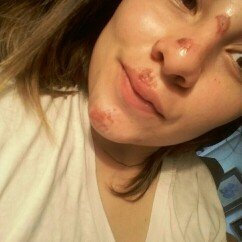 Photo of Neosporin Plus Pain Relief uploaded by Natalia M.