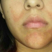 Acne Free AcneFree Advanced Cleansing Brush uploaded by Veronica M.