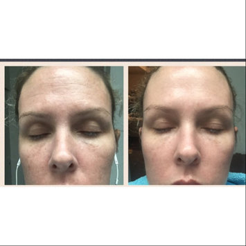 Photo of Obagi Nu-Derm Blend Fx Face Treatment Formula uploaded by Jennifer S.
