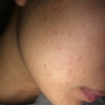 Photo of Hada Labo Shirojyun Lotion uploaded by Gianna B.